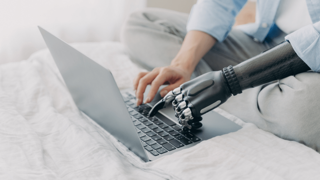 persona con prótesis en el brazo, escribiendo en el ordenador